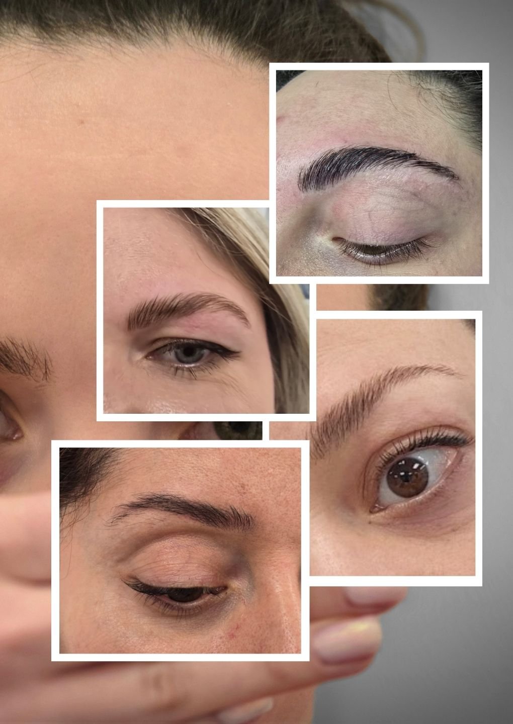 BROWLIFT PHOTO